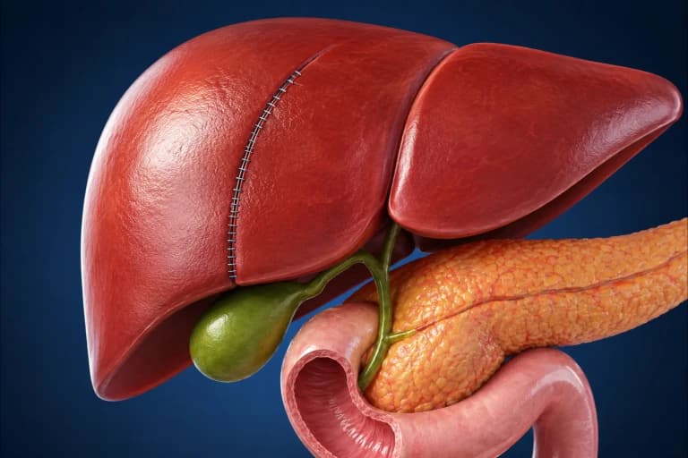 Liver Surgery